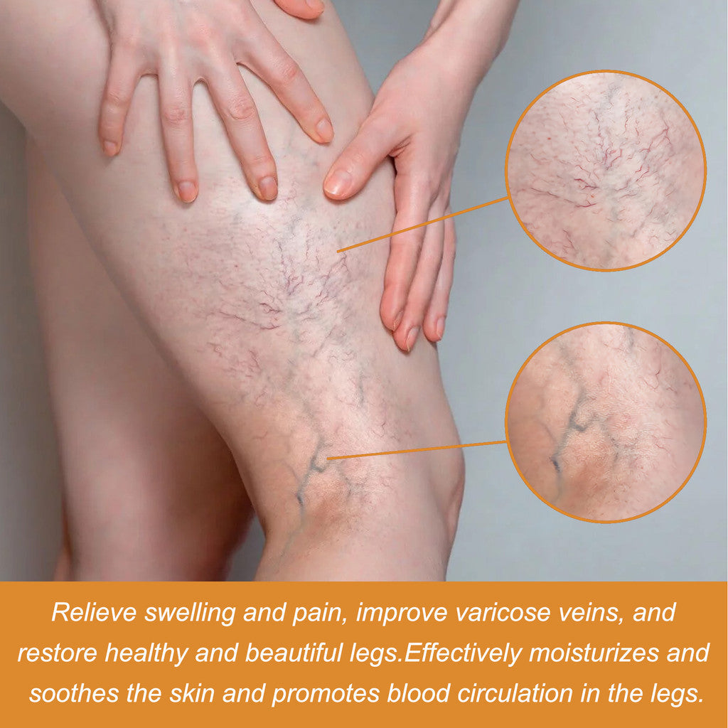 Varicose Vein Relief Spray (Buy 1 Get 2 Free 😍)