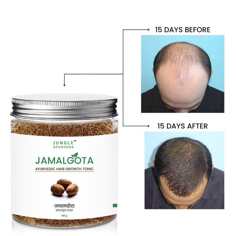 Jamalgota™ Ayurvedic Hair Growth Powder - (Buy 1 Get 1 FREE 🔥🔥)
