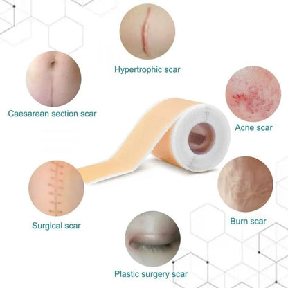 Silicone Scar Remover Tape for Acne & Wrinkles