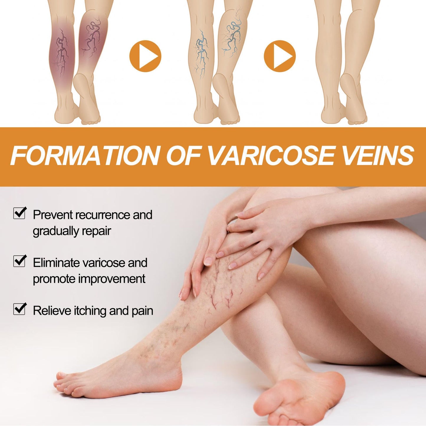 Varicose Vein Relief Spray (Buy 1 Get 2 Free 😍)