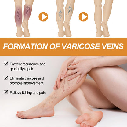 Varicose Vein Relief Spray (Buy 1 Get 2 Free 😍)