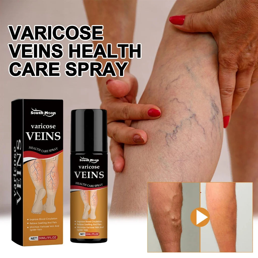 Varicose Vein Relief Spray (Buy 1 Get 2 Free 😍)