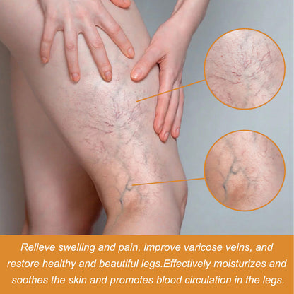 Varicose Vein Relief Spray (Buy 1 Get 2 Free 😍)